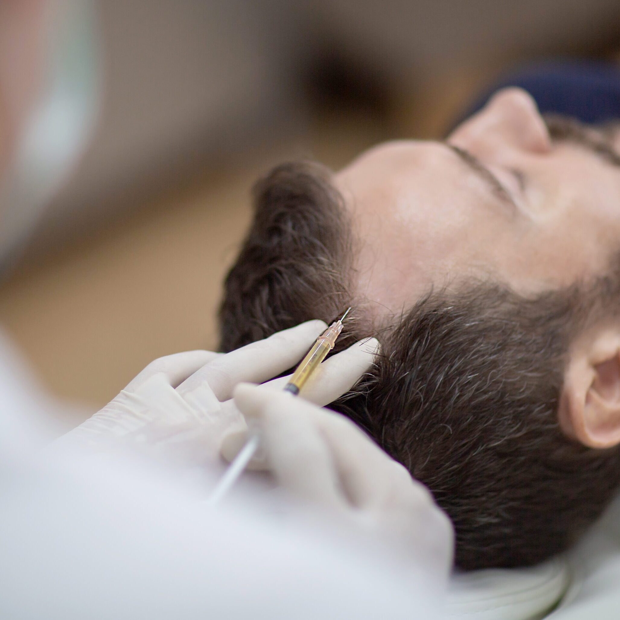 A doctor performs a hair transplant procedure on a patient.